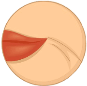 Зморшки навколо губ Зморшки навколо губ
