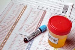 Белые прыщи: как лечить, причины, диагностика Белые прыщи: как лечить, причины, диагностика