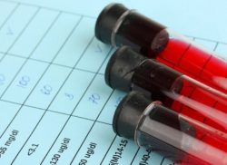 Могут ли быть от гастрита прыщи и что делать с проблемой? Могут ли быть от гастрита прыщи и что делать с проблемой?