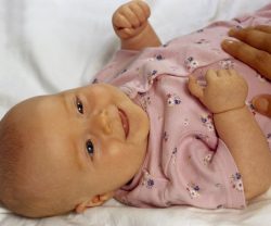 Прыщи на голове у ребенка: причины, лечение, профилактика Прыщи на голове у ребенка: причины, лечение, профилактика