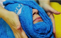 Прыщи вокруг рта: причины у детей, женщин и мужчин Прыщи вокруг рта: причины у детей, женщин и мужчин