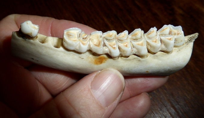 Чому зуби темніють: причини потемніння емалі