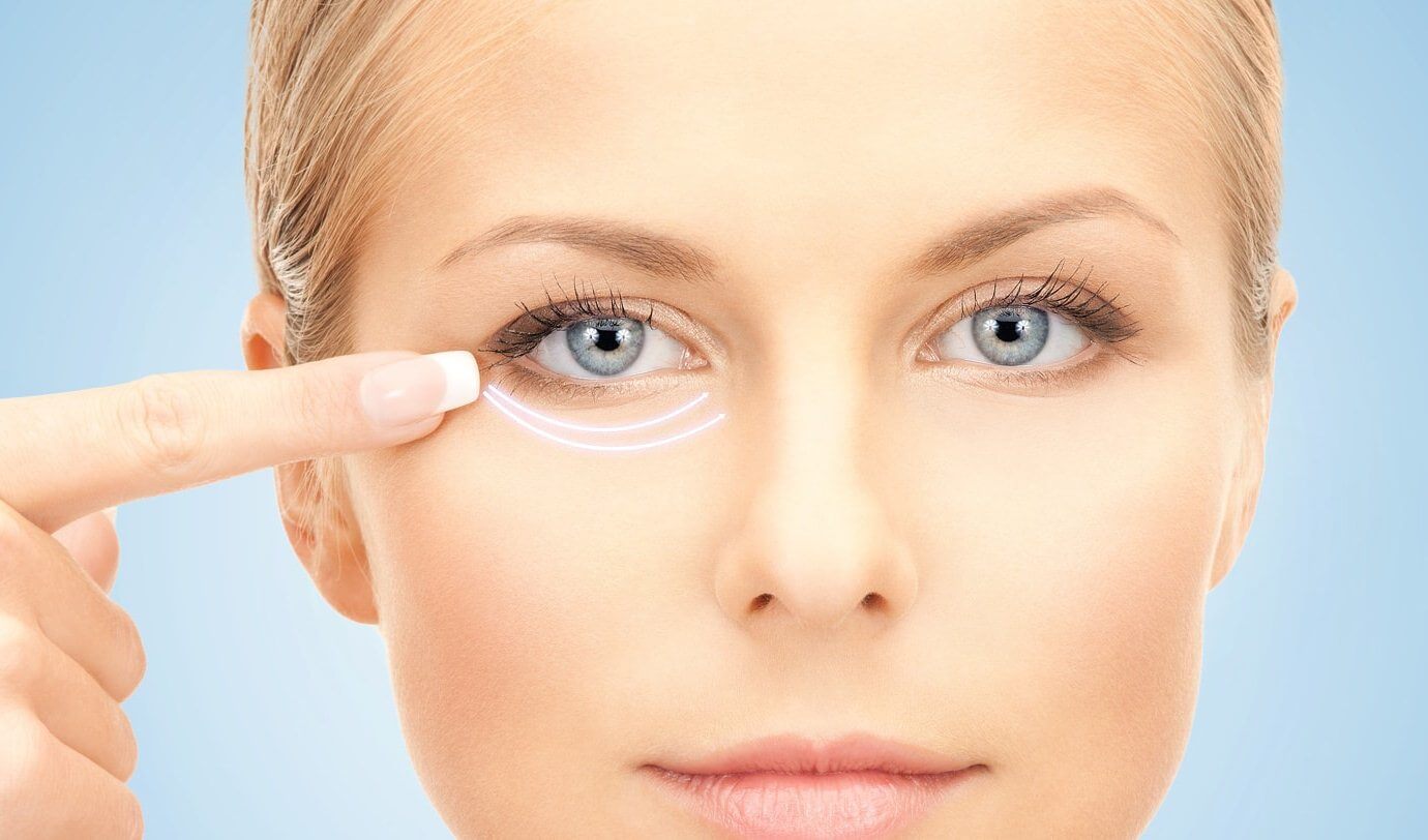 Блефаропластика