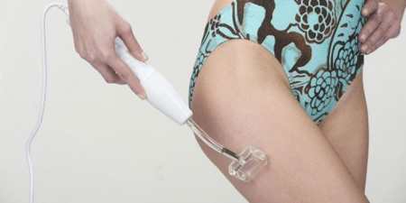 Дарсонваль від целюліту — механізм дії, протипоказання