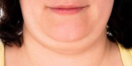 Фотоомолодження шкіри — протипоказання, можливі наслідки