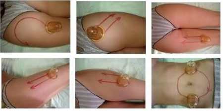 Целюліт — як прибрати масажем, кремами, або обгортанням банками