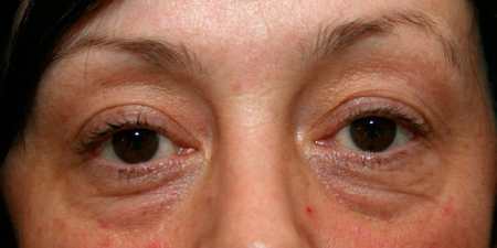 Іспанський хіромасаж — показання, переваги і недоліки процедури