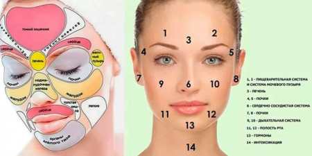 9 способів прибрати прищі на носі аптечними і народними засобами