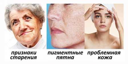 Уколи краси для обличчя: процедури для омолодження шкіри