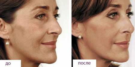 Біорепарация – що це таке, використовувані препарати, протипоказання