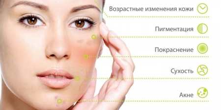 Кислотний пілінг для обличчя в домашніх умовах — який вибрати