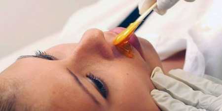 Видалення волосся на обличчі назавжди без наслідків