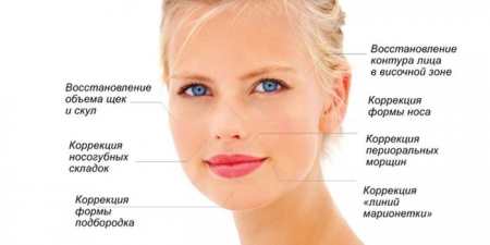 Біоармування обличчя – що це таке, плюси і мінуси, протипоказання