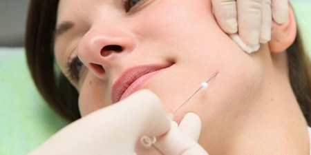 Золоті нитки для обличчя: підтяжка шкіри та відгуки