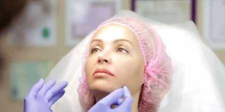 Нитки для підтяжки обличчя — види, способи закріплення, етапи операції, реабілітація, відгуки з фото до і після