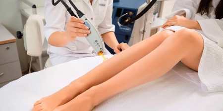 Епіляція олександритовим лазером — показання та особливості, наслідки