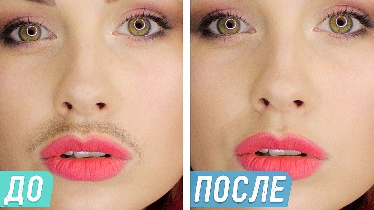 Видалення волосся над верхньою губою - як краще позбутися жінці