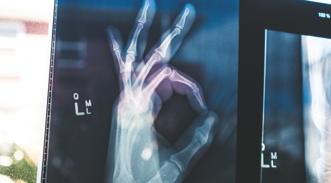 Дівам потрібно зайнятися гімнастикою, а Водоліям — більше гуляти: ЗОЖ-гороскоп для всіх знаків зодіаку на квітень