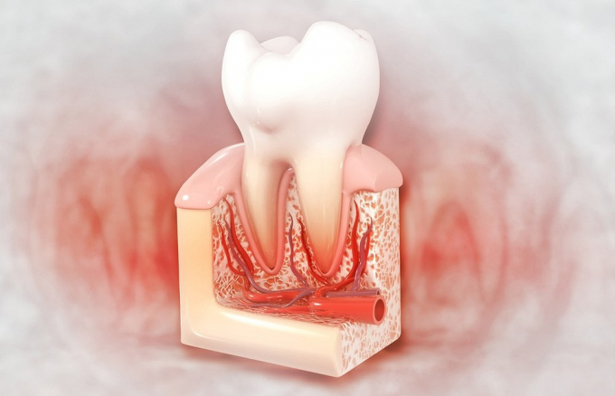 Захворювання нервів щелепно-лицьової зони: що робити у кожному випадку