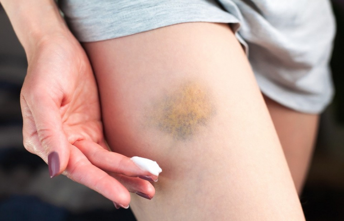 Що робити при ударі (5 найважливіших кроків) і хто в зоні ризику ускладнень