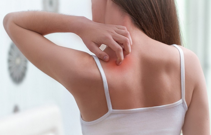 Сверблячка шкіри: причини, про які ти могла не здогадуватися