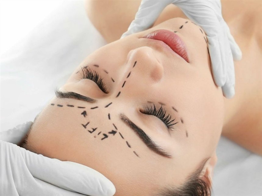 Що таке нитковий ліфтинг: особливості процедури