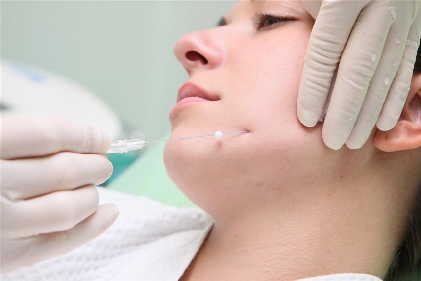 Косметичні процедури, які прибирають друге підборіддя