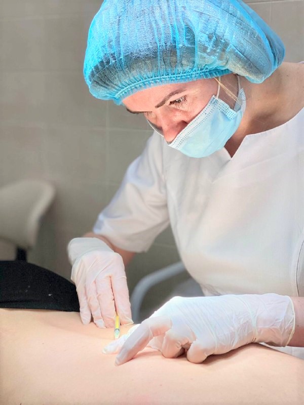 Родимки - коли треба видаляти