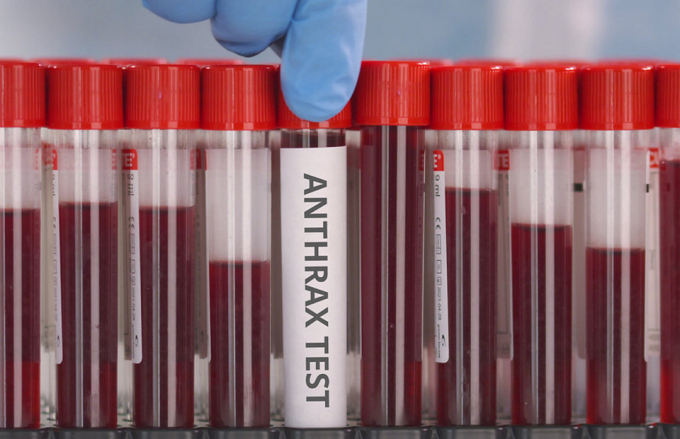 Симптоми сибірки у людини: чи є лікування і чи можна захиститися від хвороби