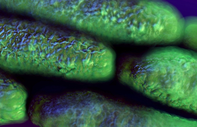 Симптоми сибірки у людини: чи є лікування і чи можна захиститися від хвороби