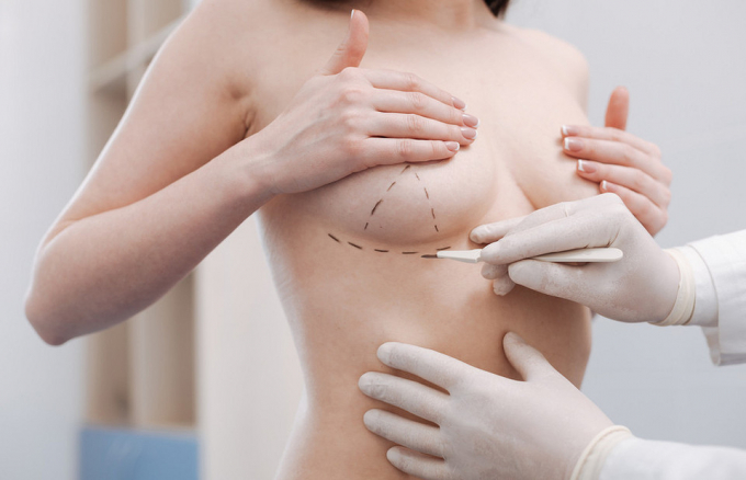 Поверніть, як було: 4 пластичні операції, від яких сьогодні все частіше відмовляються