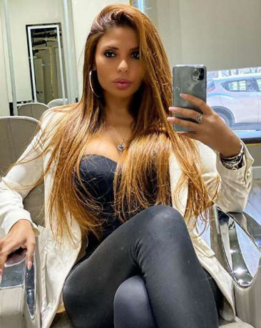 І навіть там: чому інтимна пластика популярна та які зірки її вже зробили