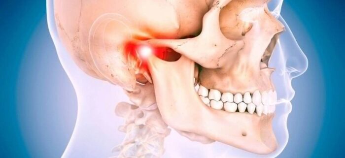 Дисфункция ВНЧС