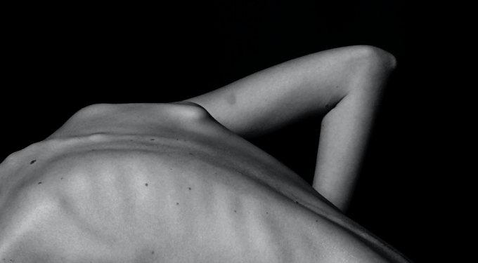 Остеопороз: перевір, чи ти перебуваєш у групі ризику