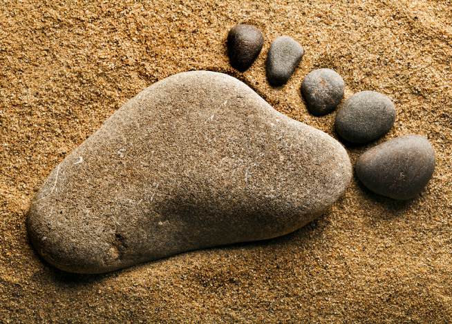 Як прибрати кісточку на нозі без операції: поради лікаря