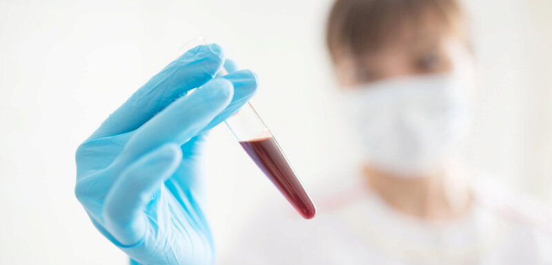 Гематолог Днепр