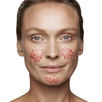 Розацеа та купероз