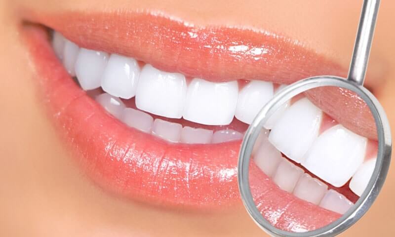 Реставрация зубов