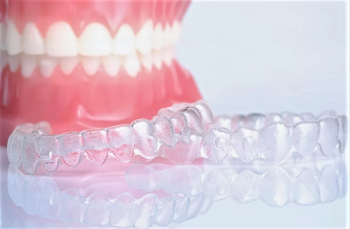 елайнери в Одесі